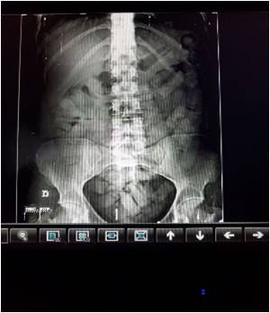 Dos-pasajeras-de-nacionalidad-venezolana-pretendían-transportar-cocaína-en-un-crucero